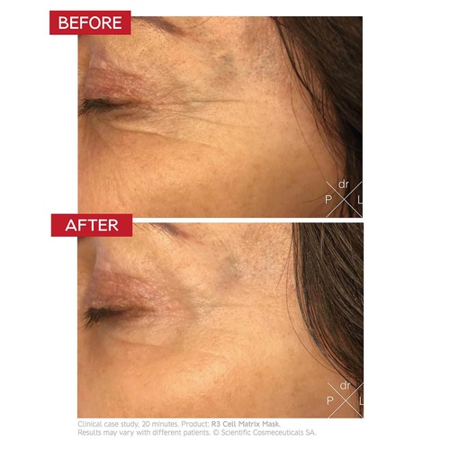 Views 4.5 Rating  635 love it  Dr. Levy Switzerland  R3 Cell Matrix Mask